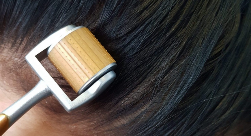 using-a-derma-roller-on-hair